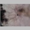 Neuronas Golgi 36.jpg